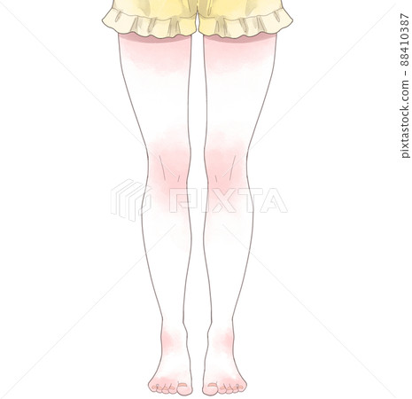 肌肉肥胖女人的腿 肌肉肥胖女人的腿 88410387