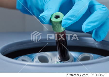 Beautician doctor's hands put test tube with blood in centrifuge container. Rejuvenation plasmolifting procedure. Beautician doctor's hands put test tube with blood in centrifuge container. Rejuvenation plasmolifting procedure. 88414829