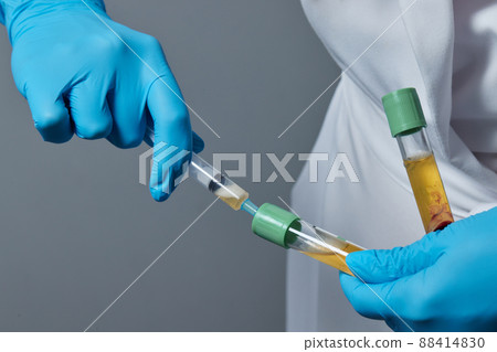 Beautician doctor's hands put test tube with blood in centrifuge container. Rejuvenation plasmolifting procedure. 88414830