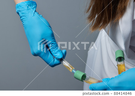 Beautician doctor's hands put test tube with blood in centrifuge container. Rejuvenation plasmolifting procedure. 88414846