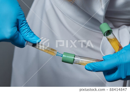 Beautician doctor's hands put test tube with blood in centrifuge container. Rejuvenation plasmolifting procedure. Beautician doctor's hands put test tube with blood in centrifuge container. Rejuvenation plasmolifting procedure. 88414847
