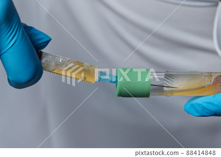 Beautician doctor's hands put test tube with blood in centrifuge container. Rejuvenation plasmolifting procedure. Beautician doctor's hands put test tube with blood in centrifuge container. Rejuvenation plasmolifting procedure. 88414848