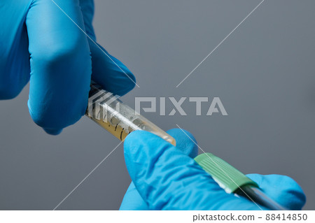 Beautician doctor's hands put test tube with blood in centrifuge container. Rejuvenation plasmolifting procedure. Beautician doctor's hands put test tube with blood in centrifuge container. Rejuvenation plasmolifting procedure. 88414850