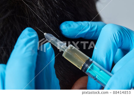 Injection plasma into head hair man cosmetologist doctor. Injection plasma into head hair man cosmetologist doctor. 88414853