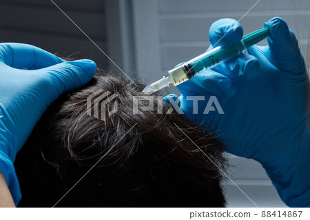 Injection plasma into head hair man cosmetologist doctor. Injection plasma into head hair man cosmetologist doctor. 88414867