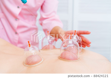 Relaxed young woman receiving canning on her back at spa. Vacuum massage. Woman 88424121