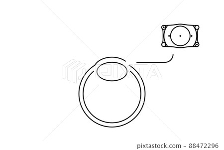 Illustrated ICL (Intraocular Contact Lens) Surgery, ICL Insertion Illustrated ICL (Intraocular Contact Lens) Surgery, ICL Insertion 88472296