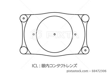 ICL, intraocular contact lenses ICL, intraocular contact lenses 88472306