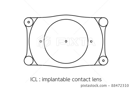 ICL, intraocular contact lenses ICL, intraocular contact lenses 88472310