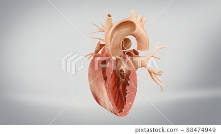 Coronary reimplantation in ascending aortic aneurysm 88474949