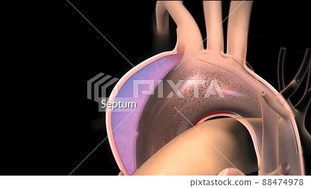 It may affect the left ventricle, aorta, aortic valve, or mitral valve. 88474978