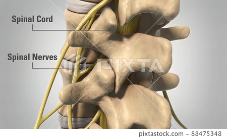 Backbone Laminectomy Degenerative Dics Disease 88475348