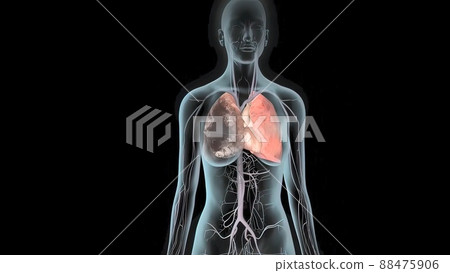 blood clot in the lung 88475906