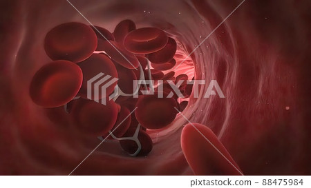 Blood clotting vascular occlusion 3d medical anatomy 88475984