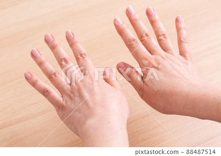 中間女人的手背 88487514
