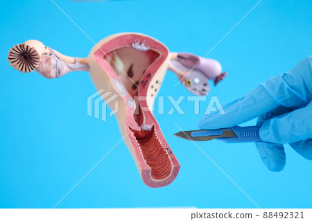 Female reproductive system anatomy uterus and scalpel closeup Female reproductive system anatomy uterus and scalpel closeup 88492321