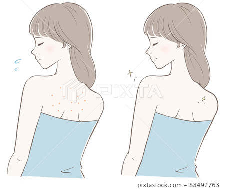 Women who care about their backs Before and after line drawing black version 88492763