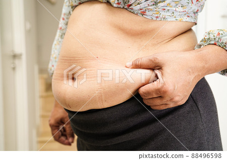 Overweight asian woman use hand to squeeze fat belly big size overweight and obesity. 88496598