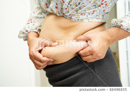 Overweight asian woman use hand to squeeze fat belly big size overweight and obesity. 88496835