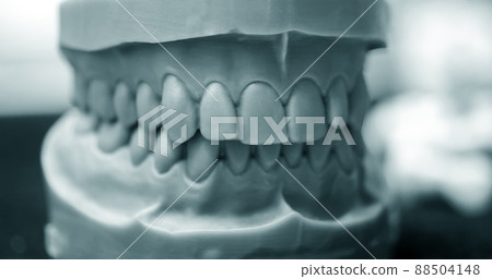 Upper and lower jaw of a man printed on a 3d printer of photopolymer 88504148