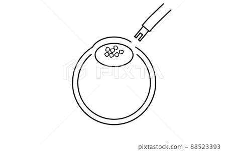 Flow of cataract surgery, illustrated illustration (line drawing), suck out cloudy crystalline lens Flow of cataract surgery, illustrated illustration (line drawing), suck out cloudy crystalline lens 88523393