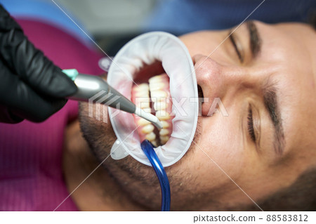 Patient of dental clinic with closed eyes and dental dam Patient of dental clinic with closed eyes and dental dam 88583812