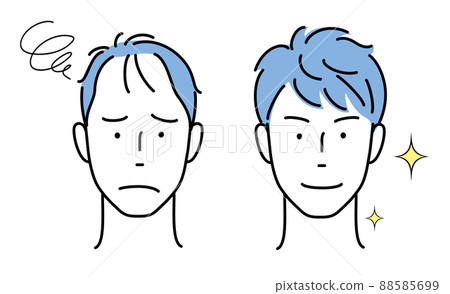 Men's head suffers from thinning hair, rich in hair Men's head suffers from thinning hair, rich in hair 88585699