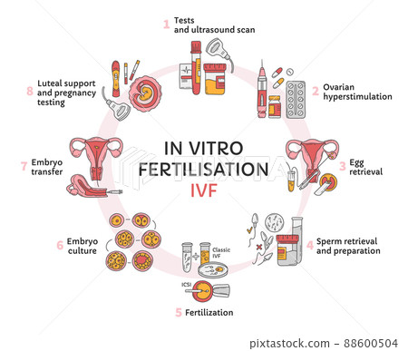 In Vitro fertilization IVF vector circle infographic and infertility treatment 88600504