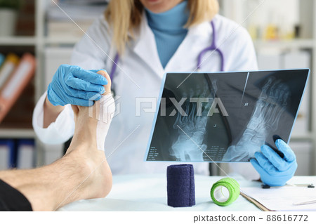 Patient with leg injury at doctor appointment closeup 88616772