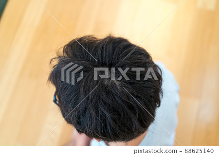 Top of the head of a man in his 40s 88625140