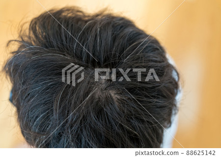 Top of the head of a man in his 40s 88625142