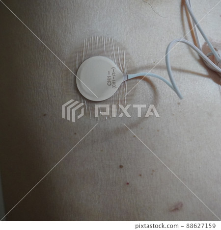 "Holter ECG wearing (right chest)" "Holter ECG wearing (right chest)" 88627159