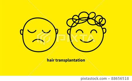 Hair transplantation, doodle icon 88656518
