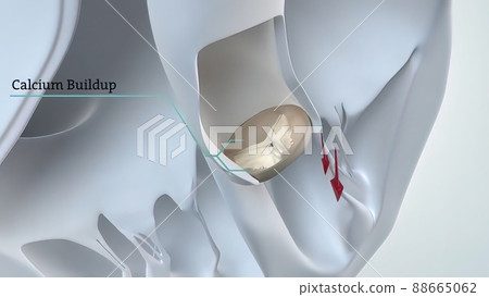 The Heart anatomy. 3D Medical of Aortic Valve The Heart anatomy. 3D Medical of Aortic Valve 88665062
