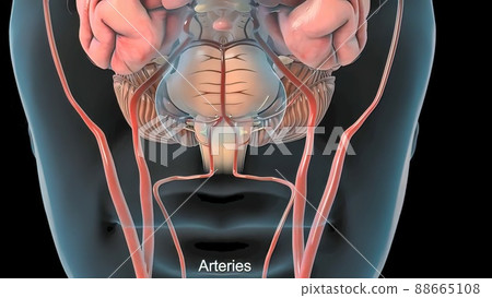 MRI of the blood vessels in the brain and cerebrovascular disease or or hemorrhagic stroke 88665108