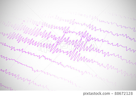 Results of electroencephalogram on paper, diagnostics of epilepsy Results of electroencephalogram on paper, diagnostics of epilepsy 88672128