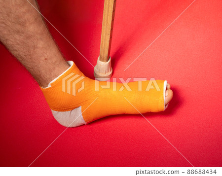 Foot with broken toe bone in orange fiberglass cast pink background. Injured fractured swollen male leg. Patient body. 88688434