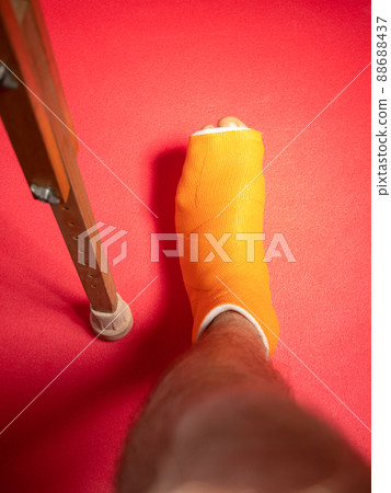 Foot with broken toe bone in orange fiberglass cast pink background. Injured fractured swollen male leg. Patient body. 88688437