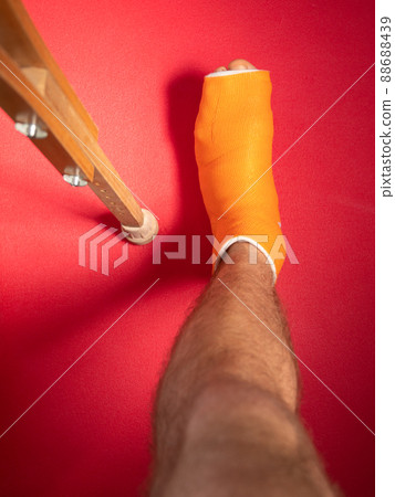 Foot with broken toe bone in orange fiberglass cast pink background. Injured fractured swollen male leg. Patient body. 88688439