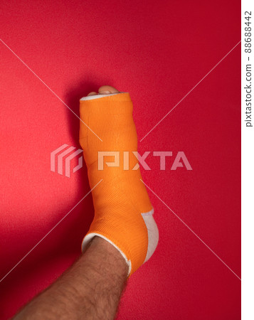 Foot with broken toe bone in orange fiberglass cast pink background. Injured fractured swollen male leg. Patient body. 88688442