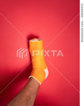 Foot with broken toe bone in orange fiberglass cast pink background. Injured fractured swollen male leg. Patient body. 88688443