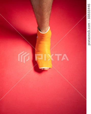 Foot with broken toe bone in orange fiberglass cast pink background. Injured fractured swollen male leg. Patient body. 88688446