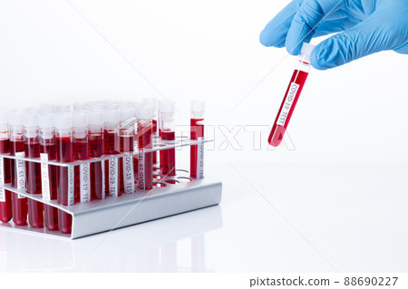 Test tubes to test for coronavirus infection. covid-19 and pandemic global concept . 88690227