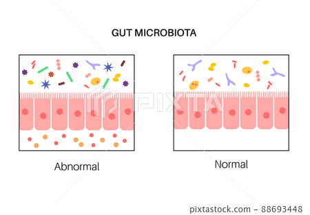 Human gut microbiota 88693448