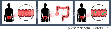 Intestines diseases concept 88699194