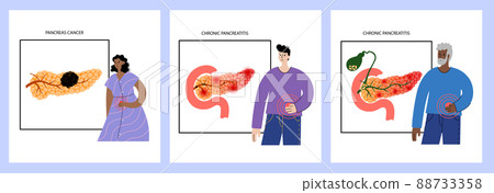 Pancreas disease and cancer 88733358
