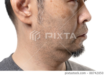 Double chin middle male aging slack face line anti-aging Double chin middle male aging slack face line anti-aging 88742850