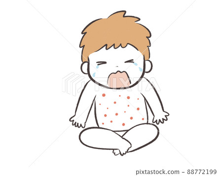 嬰兒因特應性瘙癢而哭泣 88772199