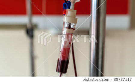 Blood transfusion serum in hospital room with blood drip. Medical concept. Blood transfusion serum in hospital room with blood drip. Medical concept. 88787117