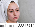 teenage girl with acne on her face. 88817314